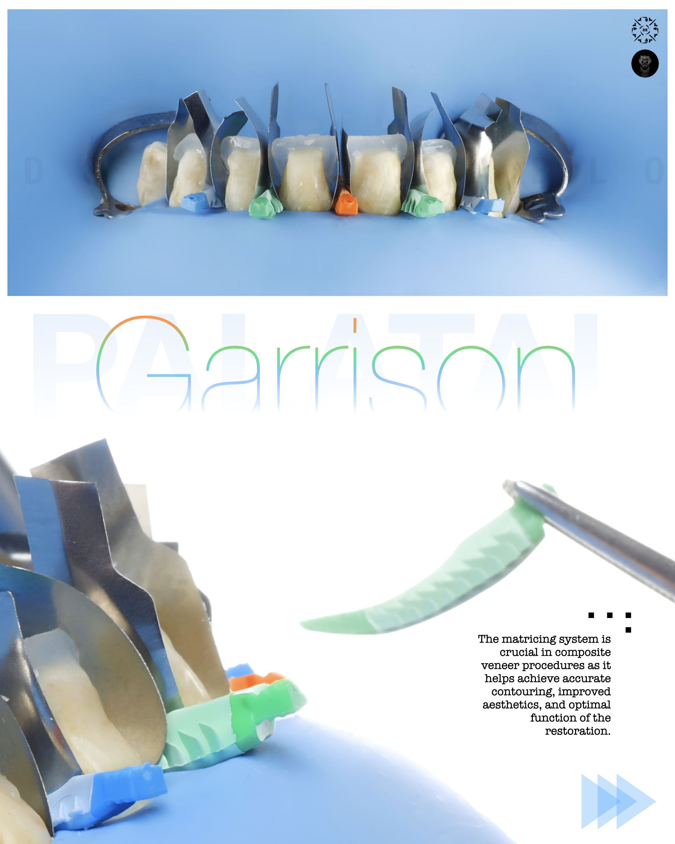 Dental photography example 4