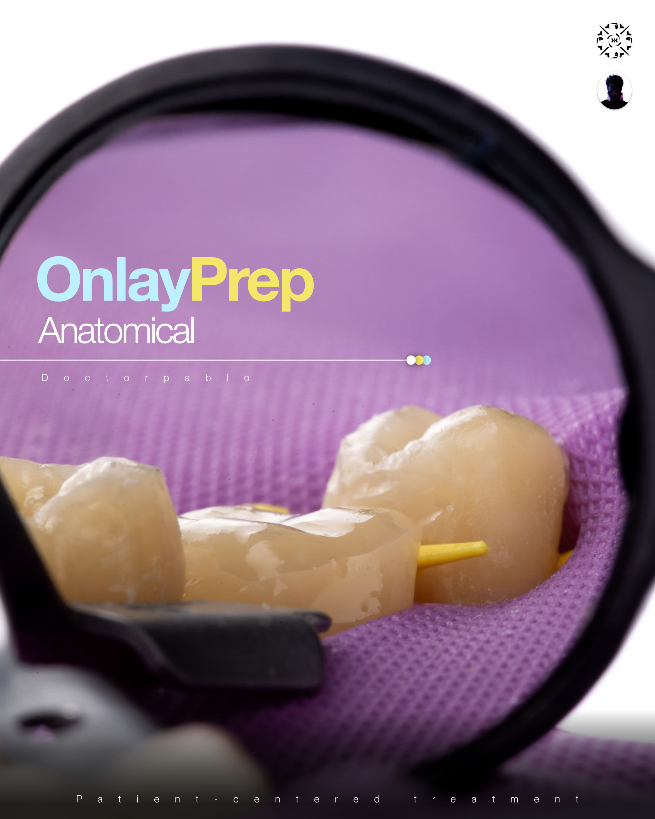 Dental photography example 2