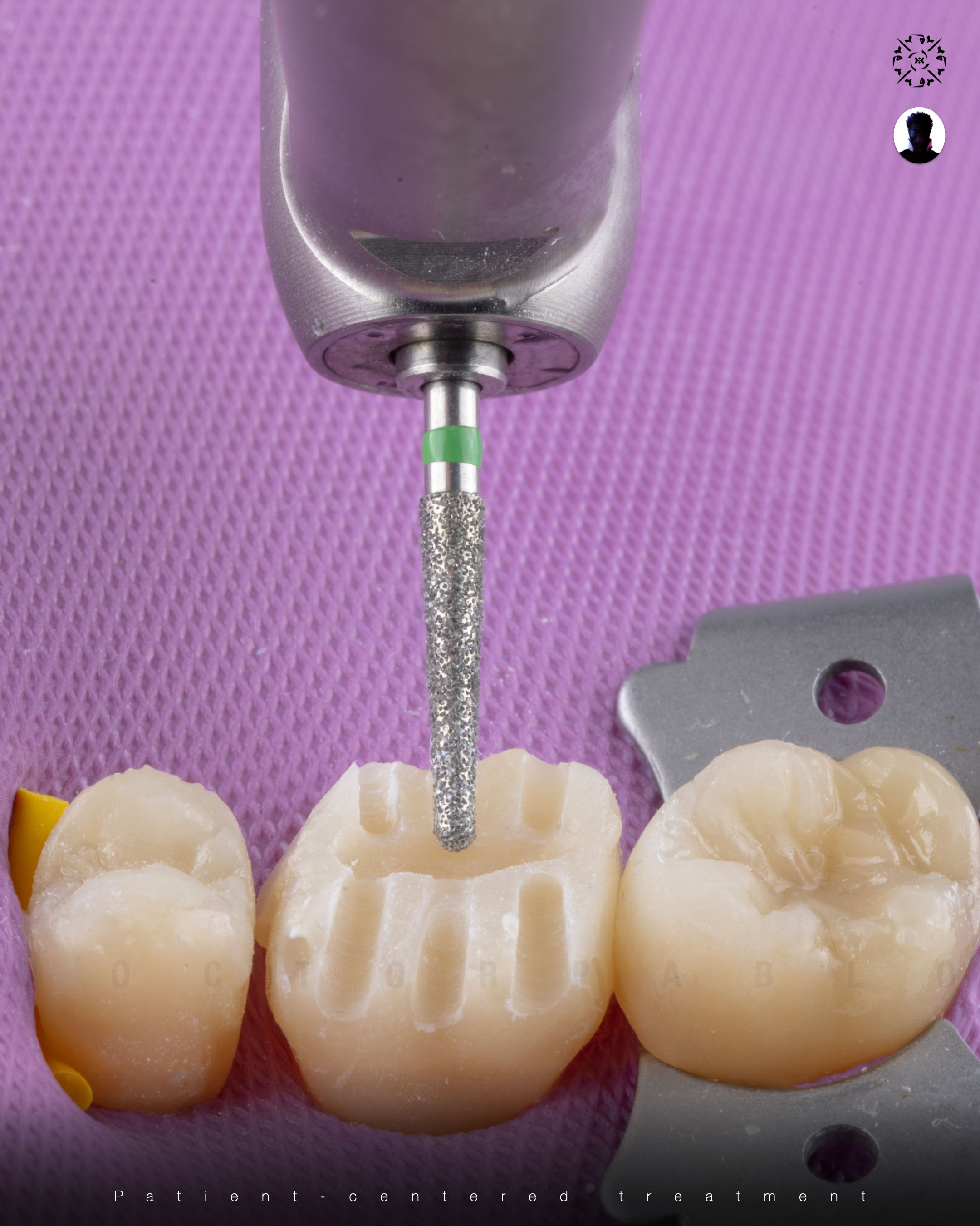 Dental photography example 8