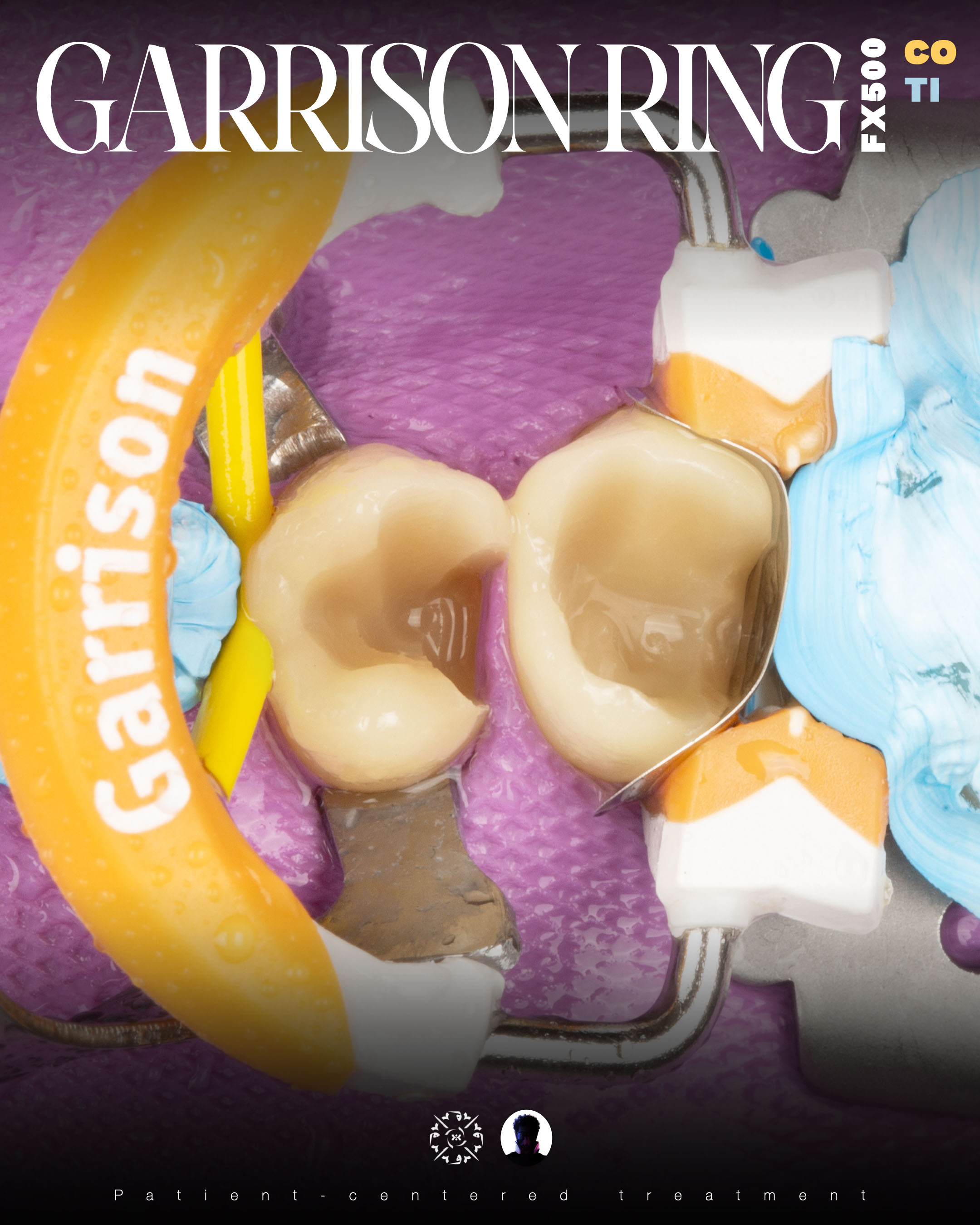 Dental photography example 3