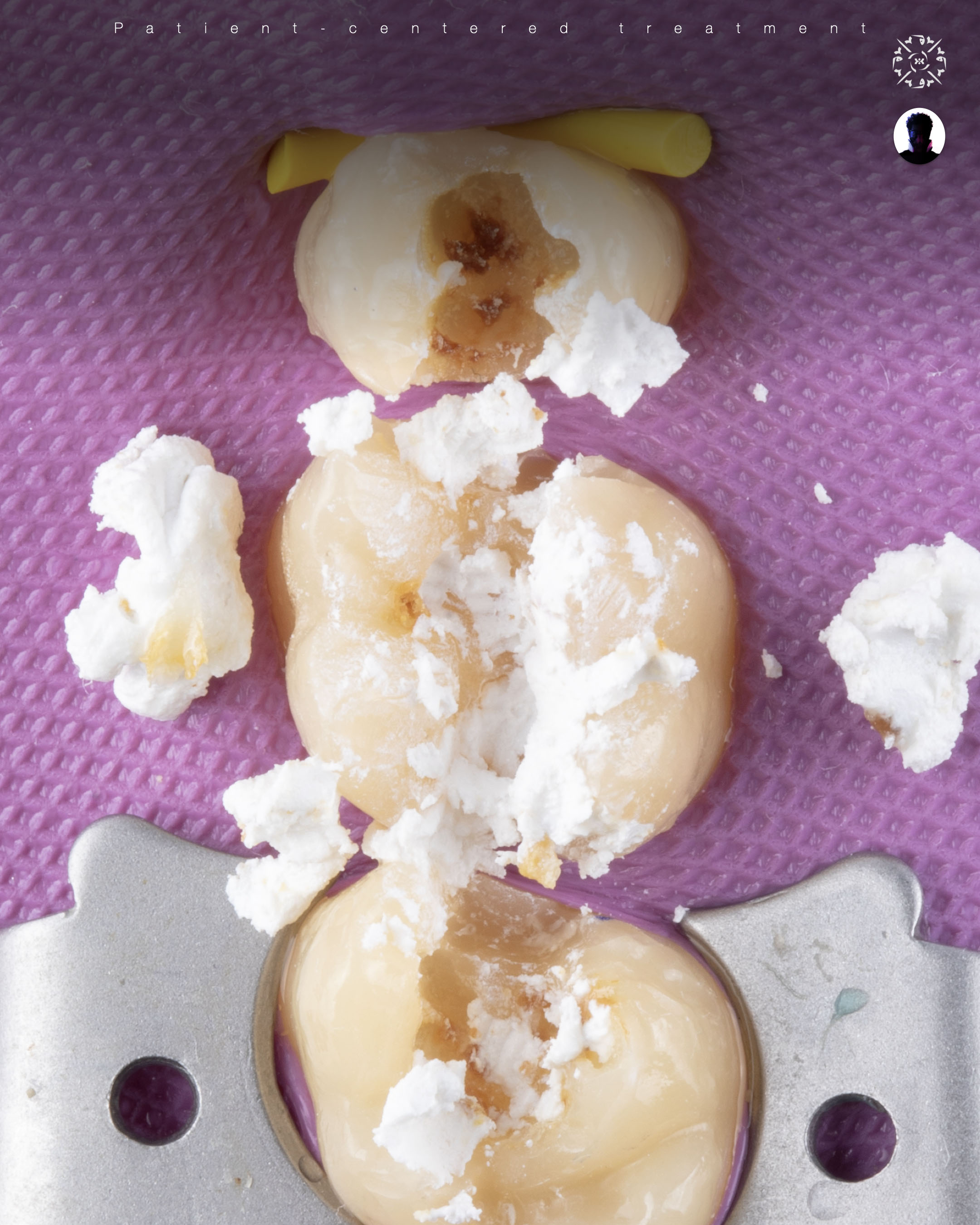 Dental photography example 6